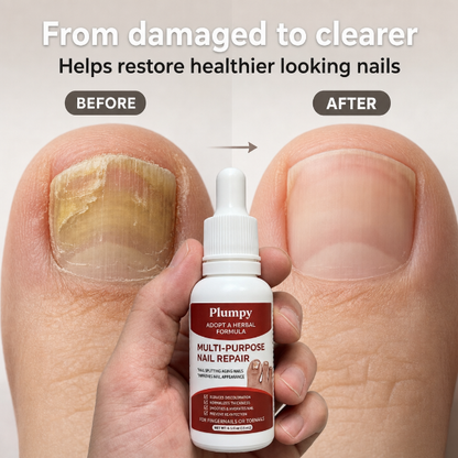 Anti Fungus